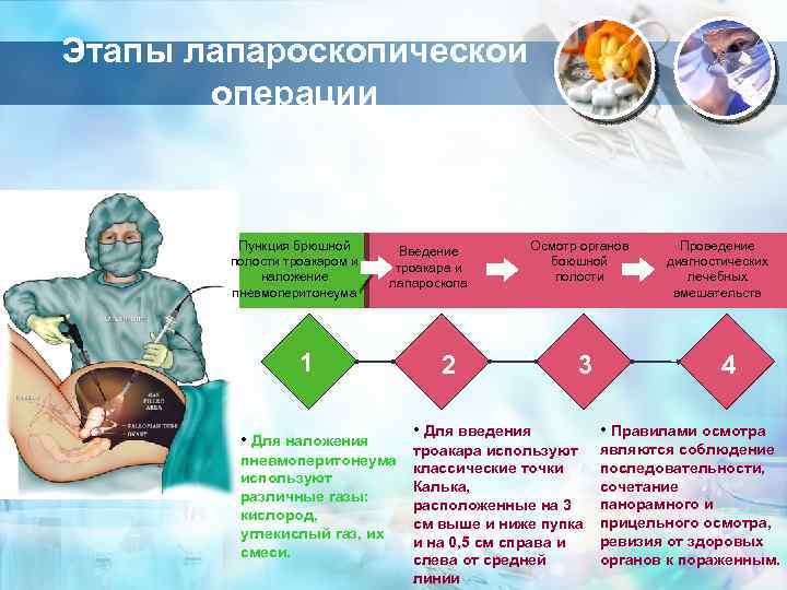 Этапы лапароскопической операции Пункция брюшной полости троакаром и наложение пневмоперитонеума Введение троакара и лапароскопа