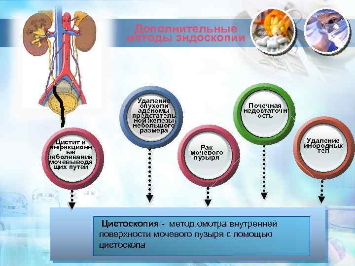 Дополнительные методы эндоскопии Удаление опухоли аденомы Text предстатель ной железы небольшого in here размера