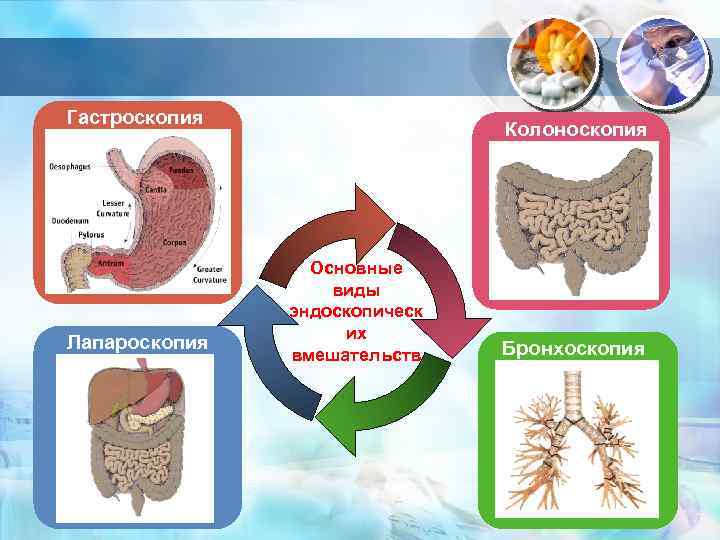 Гастроскопия Лапароскопия Колоноскопия Основные виды эндоскопическ их вмешательств Бронхоскопия 