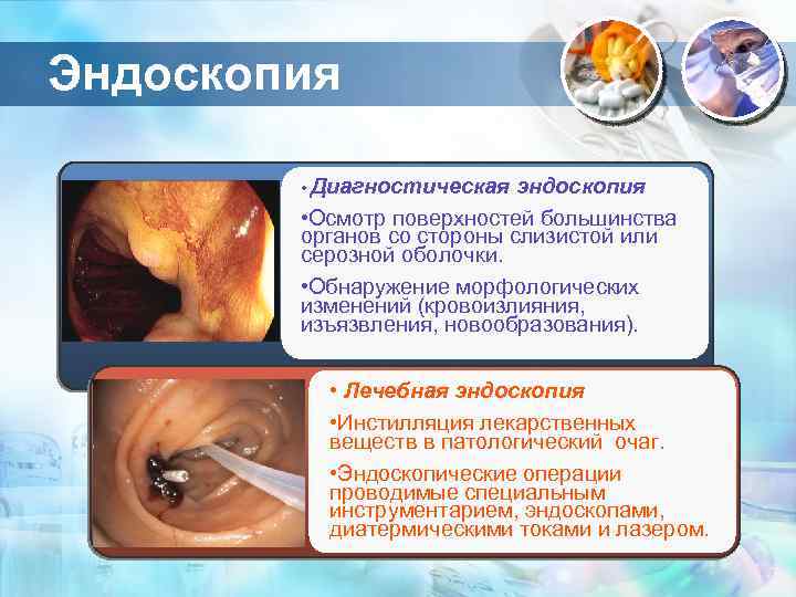 Эндоскопия • Диагностическая эндоскопия • Осмотр поверхностей большинства органов со стороны слизистой или серозной
