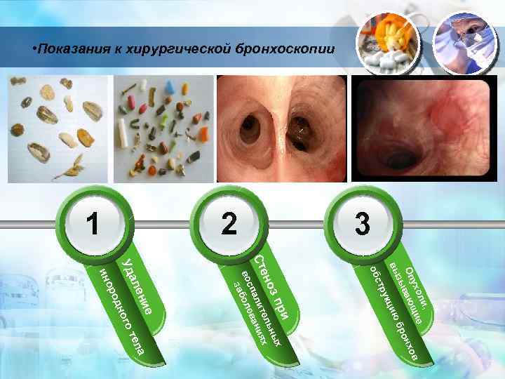  • Показания к хирургической бронхоскопии 3 2 1 укц , ли ие ухо