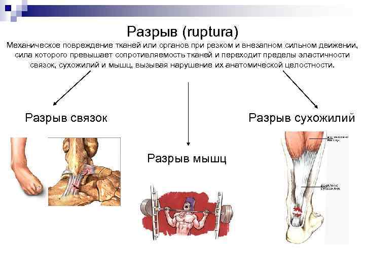 Разрыв (ruptura) Механическое повреждение тканей или органов при резком и внезапном сильном движении, сила
