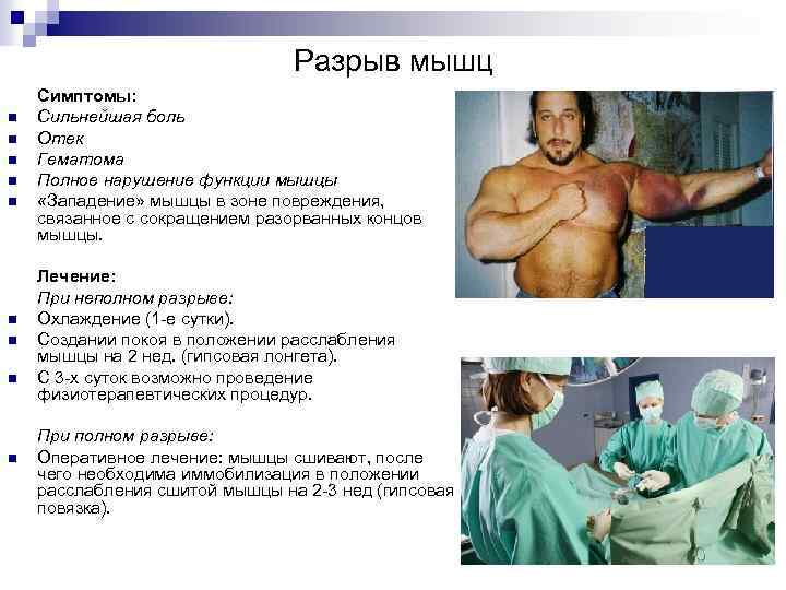 Разрыв мышц n n n n n Симптомы: Сильнейшая боль Отек Гематома Полное нарушение