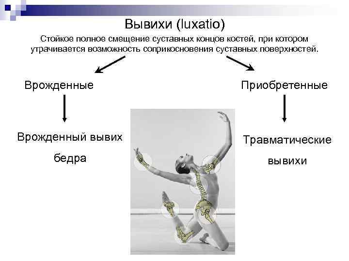 Вывихи (luxatio) Стойкое полное смещение суставных концов костей, при котором утрачивается возможность соприкосновения суставных