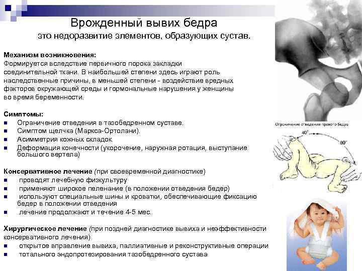 Врожденный вывих бедра это недоразвитие элементов, образующих сустав. Механизм возникновения: Формируется вследствие первичного порока