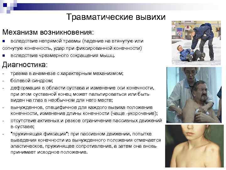 Травматические вывихи Механизм возникновения: вследствие непрямой травмы (падение на втянутую или согнутую конечность, удар