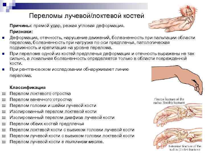 Переломы лучевой/локтевой костей n n n Ш Ш Ш Ш Ш Причины: прямой удар,