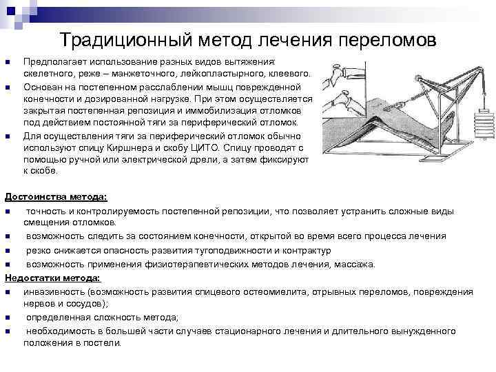 Традиционный метод лечения переломов n n n Предполагает использование разных видов вытяжения: скелетного, реже