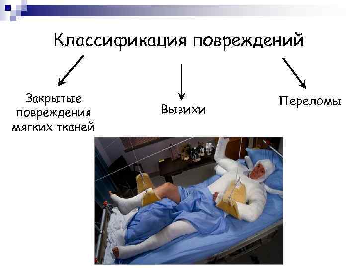 Классификация повреждений Закрытые повреждения мягких тканей Вывихи Переломы 