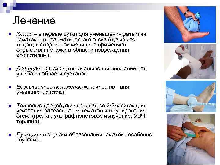 Лечение n Холод – в первые сутки для уменьшения развития гематомы и травматического отека