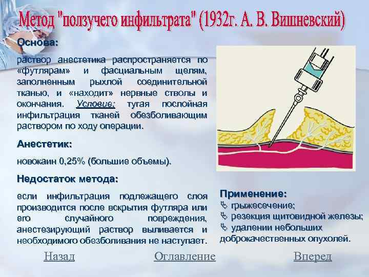 Основа: раствор анестетика распространяется по «футлярам» и фасциальным щелям, заполненным рыхлой соединительной тканью, и