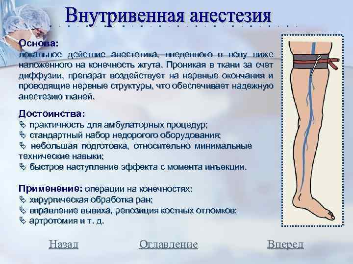 Основа: локальное действие анестетика, введенного в вену ниже наложенного на конечность жгута. Проникая в
