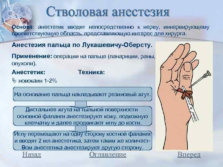 Основа: анестетик вводят непосредственно к нерву, иннервирующему соответствующую область, представляющую интерес для хирурга. Анестезия