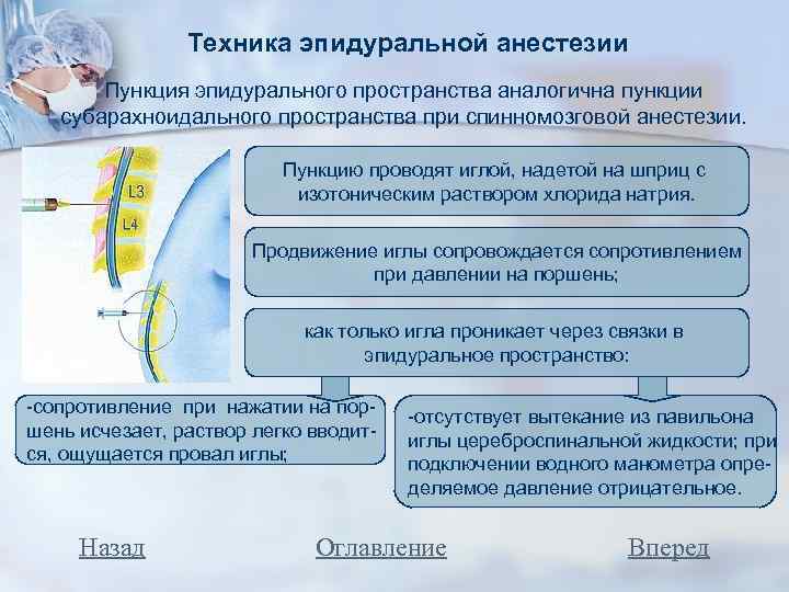 Техника эпидуральной анестезии Пункция эпидурального пространства аналогична пункции субарахноидального пространства при спинномозговой анестезии. Пункцию