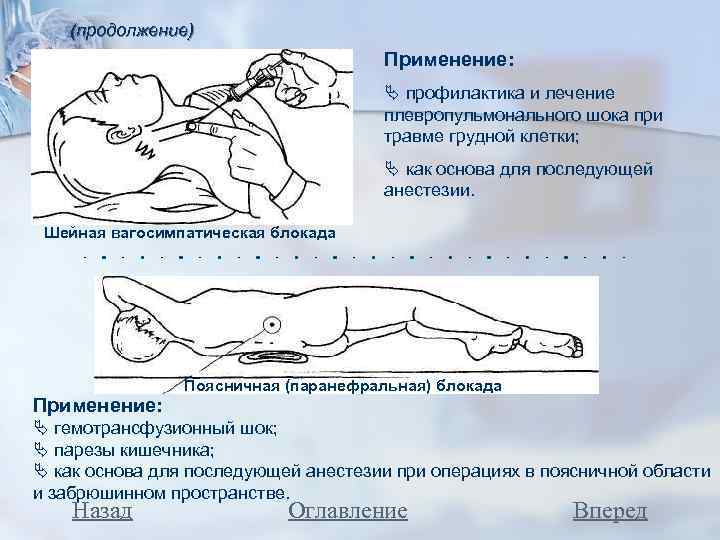 (продолжение) Применение: профилактика и лечение плевропульмонального шока при травме грудной клетки; как основа для