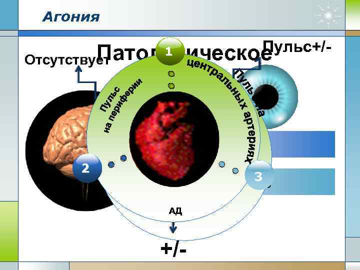 Агония Пульс+/Патологическое Отсутствует 1 Зрачок 2 1 Рефлексы +/Concept 3 Сознание угнетено +/- 