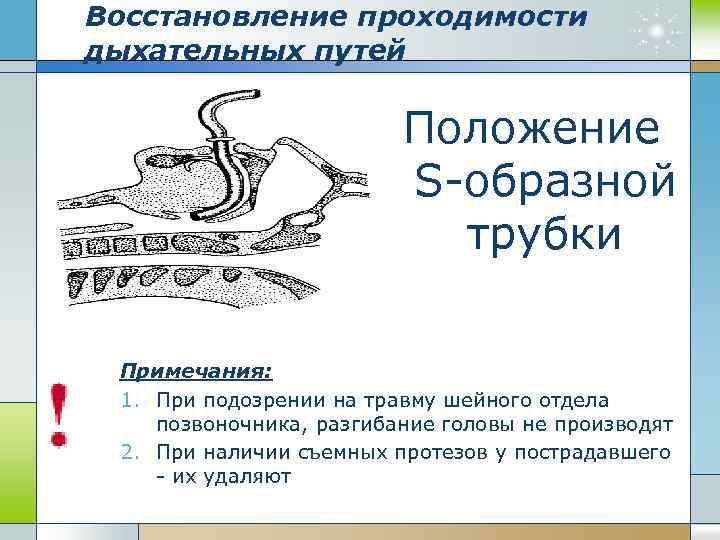 Восстановление проходимости дыхательных путей Положение S-образной трубки Примечания: 1. При подозрении на травму шейного