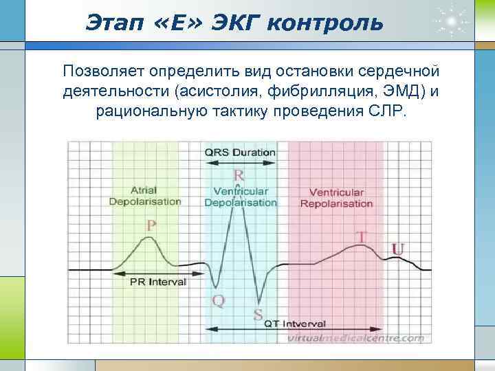 Этап «Е» ЭКГ контроль Позволяет определить вид остановки сердечной деятельности (асистолия, фибрилляция, ЭМД) и