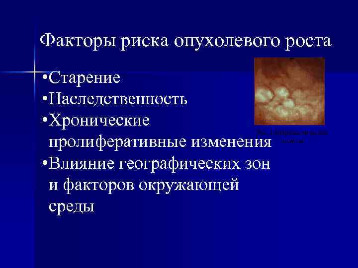 Факторы риска опухолевого роста • Старение • Наследственность • Хронические пролиферативные изменения • Влияние