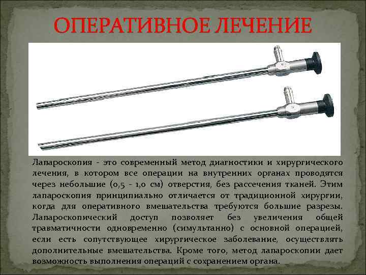 ОПЕРАТИВНОЕ ЛЕЧЕНИЕ Лапароскопия - это современный метод диагностики и хирургического лечения, в котором все