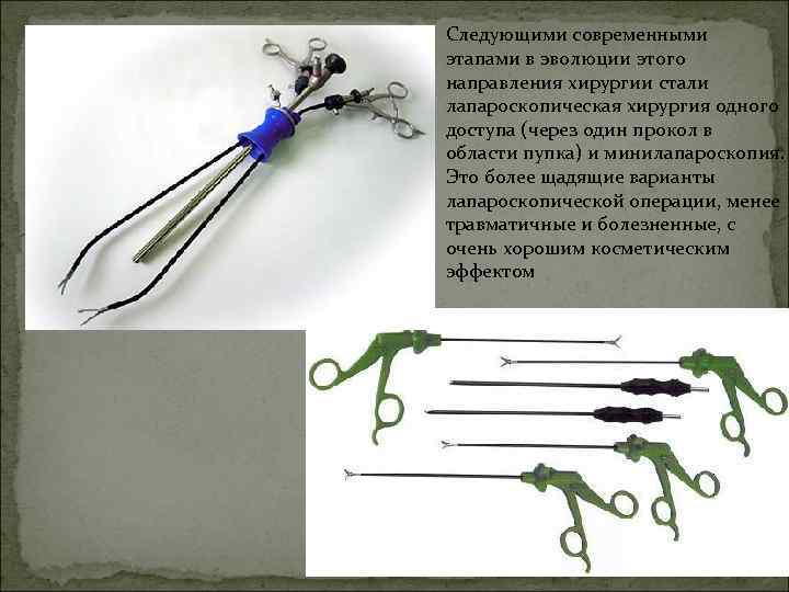 Следующими современными этапами в эволюции этого направления хирургии стали лапароскопическая хирургия одного доступа (через