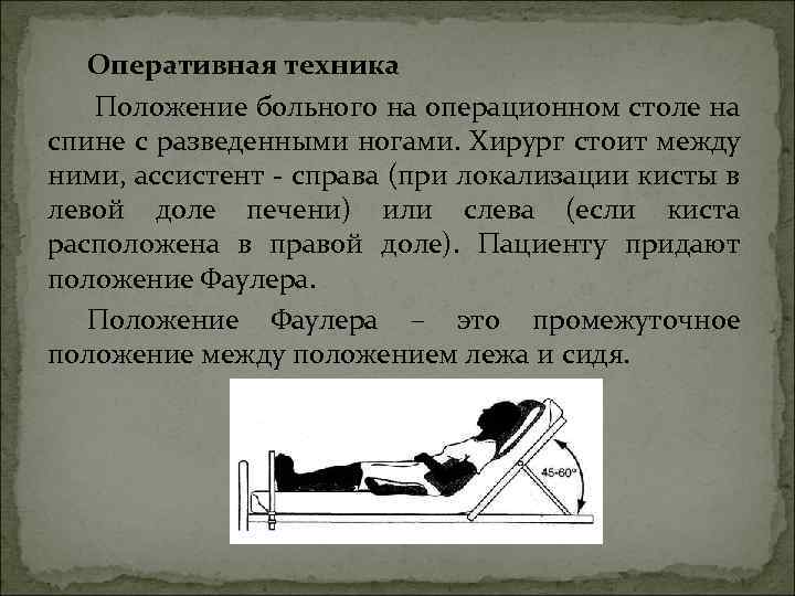 Оперативная техника Положение больного на операционном столе на спине с разведенными ногами. Хирург стоит