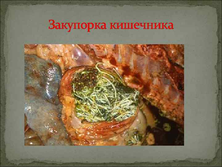 Закупорка кишечника 