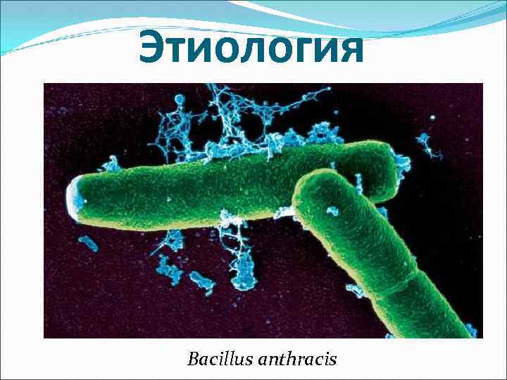 Этиология Bacillus anthracis 