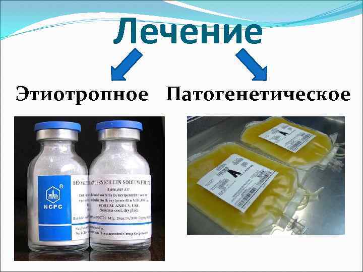 Лечение Этиотропное Патогенетическое 