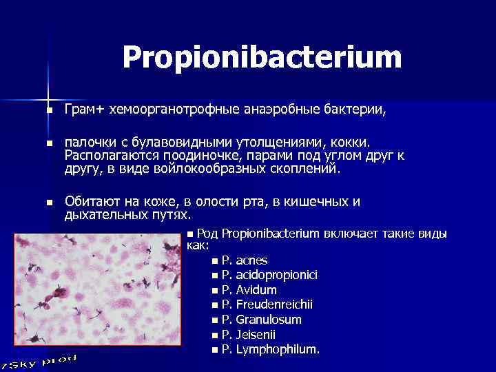 Propionibacterium n Грам+ хемоорганотрофные анаэробные бактерии, n палочки с булавовидными утолщениями, кокки. Располагаются поодиночке,