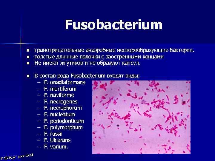 Fusobacterium n n грамотрицательные анаэробные неспорообразующие бактерии. толстые длинные палочки с заостренными концами Не