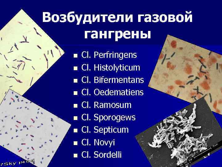 Возбудители газовой гангрены n n n n n Cl. Perfringens Сl. Histolyticum Сl. Bifermentans