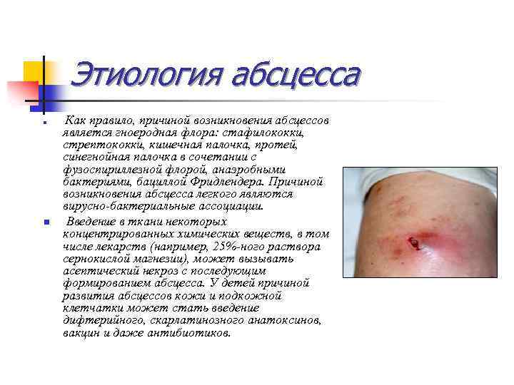 Этиология абсцесса n n Как правило, причиной возникновения абсцессов является гноеродная флора: стафилококки, стрептококки,