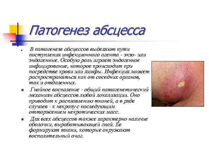 Патогенез абсцесса n n n В патогенезе абсцессов выделяют пути поступления инфекционного агента -