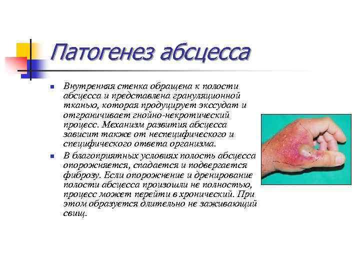 Патогенез абсцесса n n Внутренняя стенка обращена к полости абсцесса и представлена грануляционной тканью,