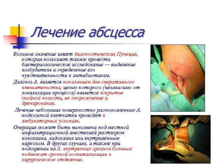 Лечение абсцесса Большое значение имеет диагностическая Пункция, которая позволяет также провести бактериологическое исследование —