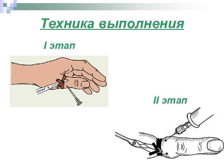 Техника выполнения I этап II этап 