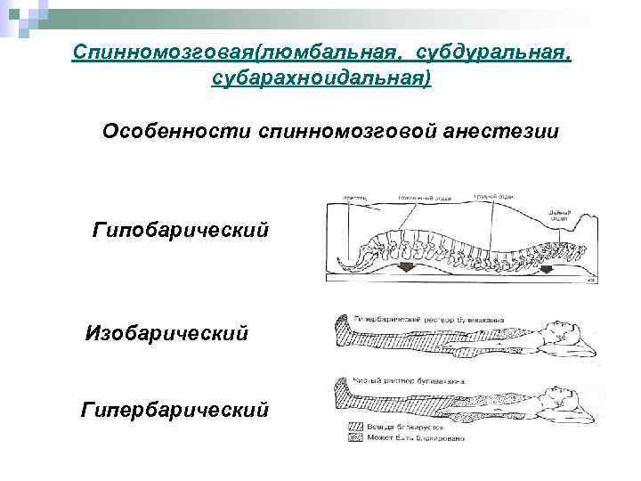 Спинномозговая(люмбальная, субдуральная, субарахноидальная) Особенности спинномозговой анестезии Гипобарический Изобарический Гипербарический 