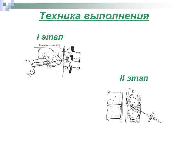 Техника выполнения I этап II этап 