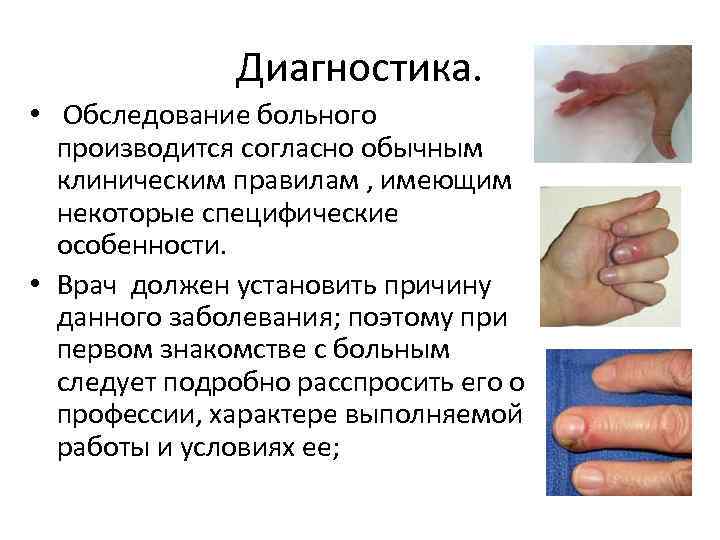 Диагностика. • Обследование больного производится согласно обычным клиническим правилам , имеющим некоторые специфические особенности.