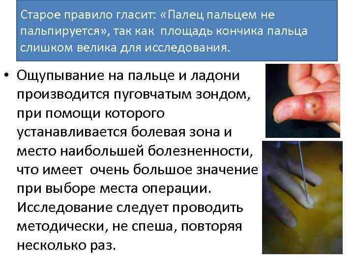 Старое правило гласит: «Палец пальцем не пальпируется» , так как площадь кончика пальца слишком
