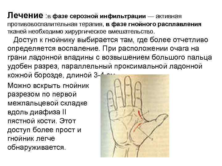 Лечение : в фазе серозной инфильтрации — активная противовоспалительная терапия, в фазе гнойного расплавления