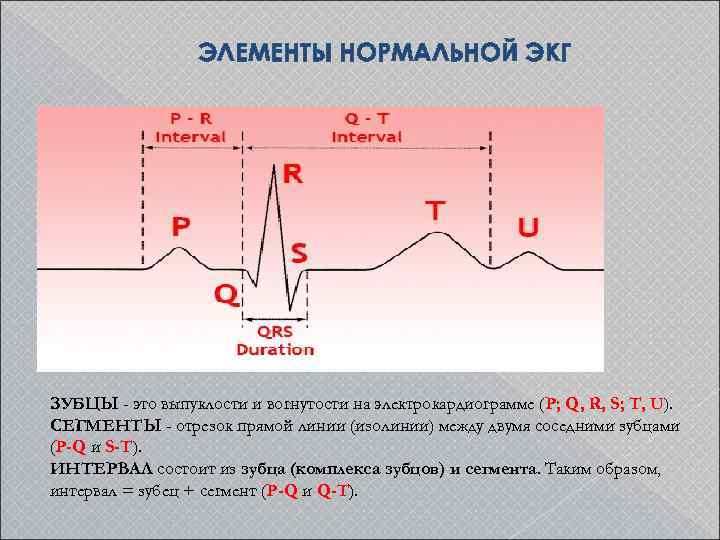 ЭЛЕМЕНТЫ НОРМАЛЬНОЙ ЭКГ ЗУБЦЫ - это выпуклости и вогнутости на электрокардиограмме (P; Q, R,