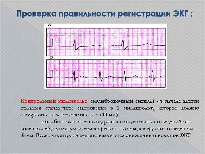 Регистрация экг