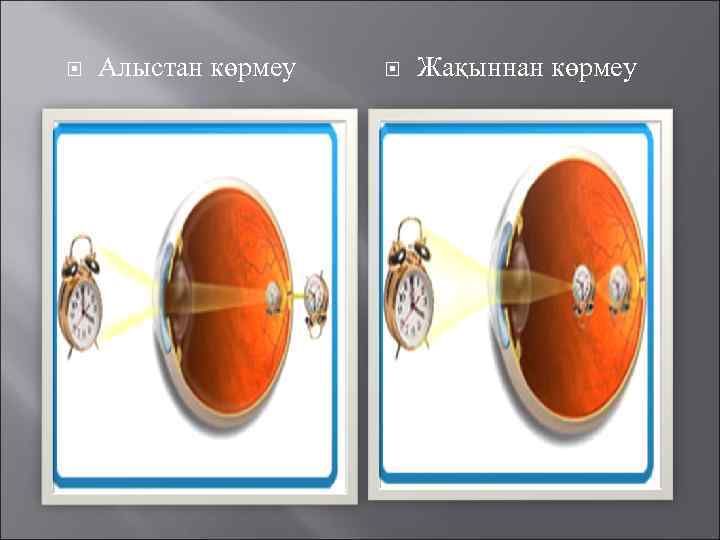  Алыстан көрмеу Жақыннан көрмеу 