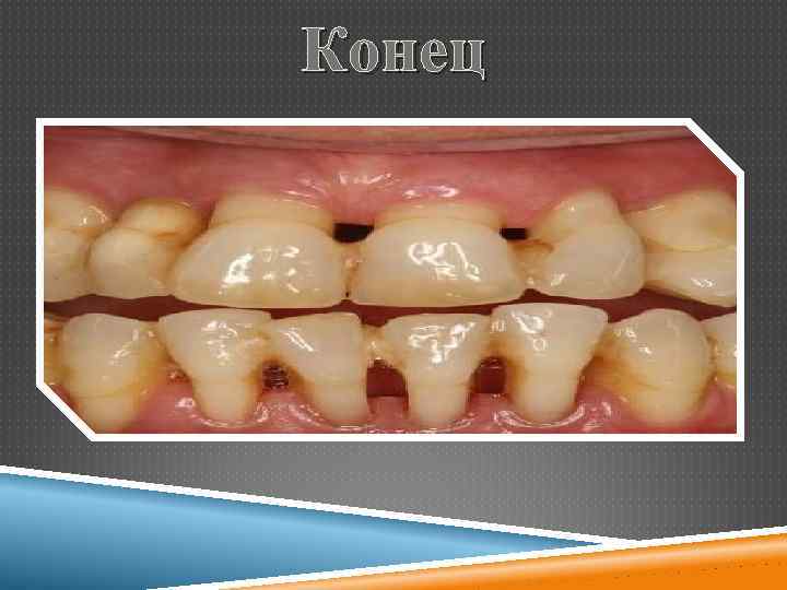 Конец 