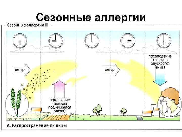Сезонные аллергии 