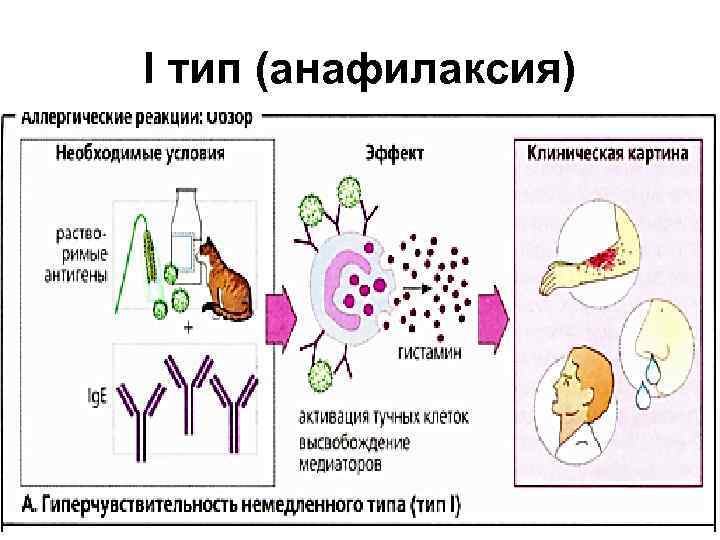 Аллергические реакции виды