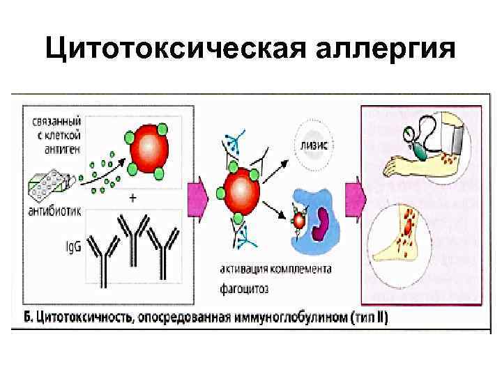 Цитотоксические аллергические реакции