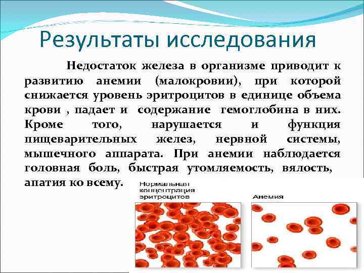 Результаты исследования Недостаток железа в организме приводит к развитию анемии (малокровии), при которой снижается